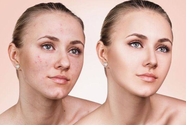 Before & After